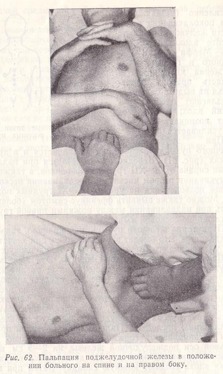 Пальпация поджелудочной железы в положении больного на спине и на правом боку